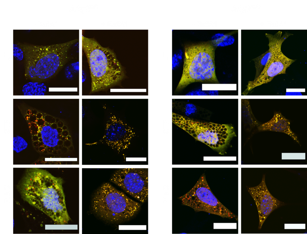 Autophagy mouse embryonic fibroblasts