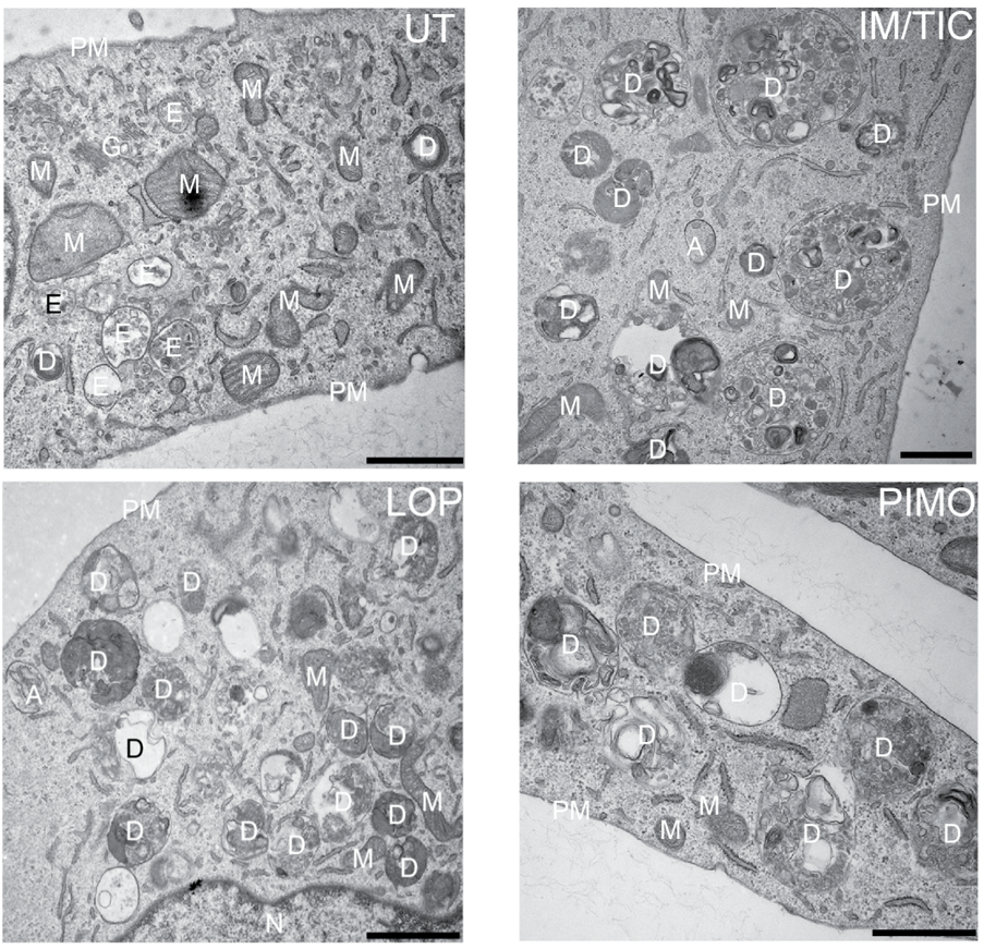 Autophagy electron microscopy