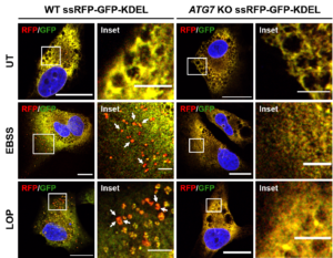 ssRFP-GFP-KDEL ER-sensor EBSS Loperamide ER-phagy reticulophagy
