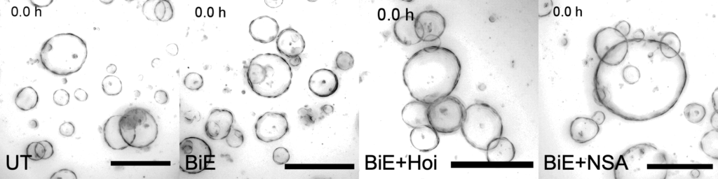 Pancreas organoids necroptosis LUBAC linear ubiquitination MLKL necroptosis Goethe University